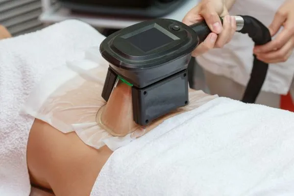 Image of person having fat freezing treatment to help weight gain Hounslow