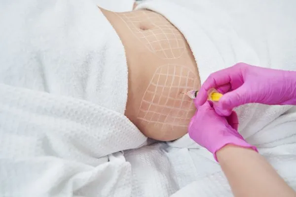 image of fat dissolving injections on love handles to help combat weight gain Hounslow