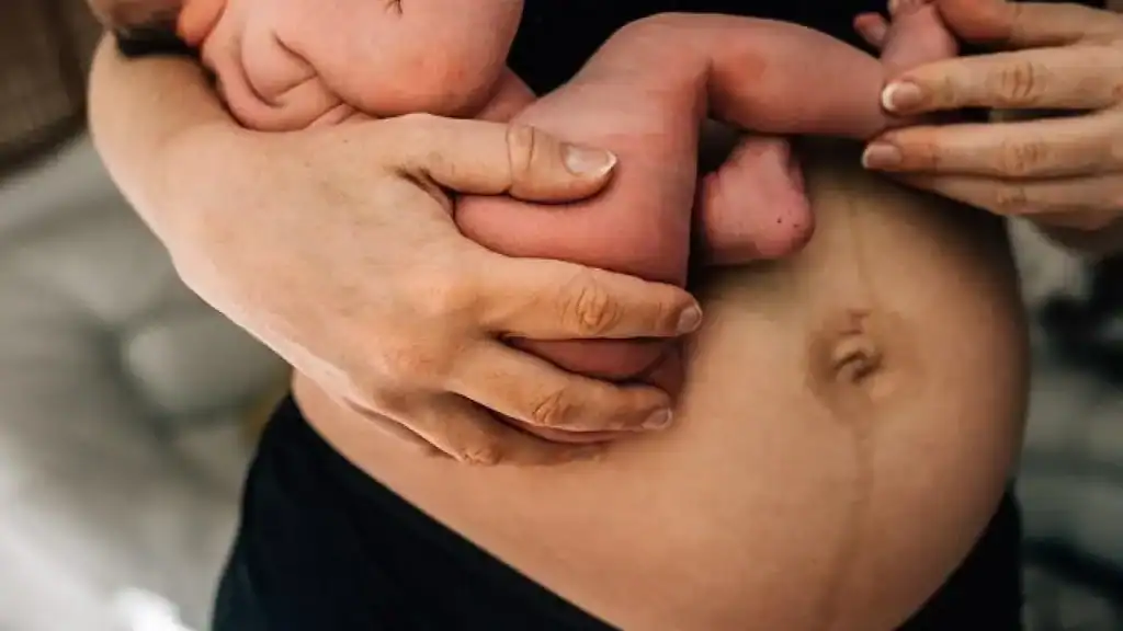 Why Is My Stomach Still Big After Pregnancy Hounslow?